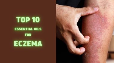Top 10 Essential Oils For Eczema | Health Tips | Sky world 4 1680943527 maxresdefault