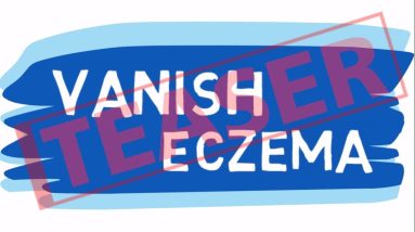 Eczema Cure: A Natural and Proven 3 Step System 16 1680966379 maxresdefault