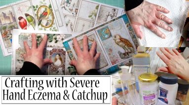 Crafting and Dealing With Severe Hand Eczema and Catch Up. 6 1680969777 maxresdefault