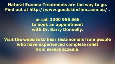 Natural Eczema Treatment gets Lasting Results 2 1680970116 maxresdefault