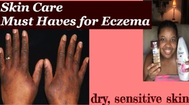 Must Haves: Eczema & Dry Skin 10 1680973968 maxresdefault