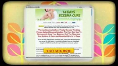 Is Eczema Contagious : Is Eczema Contagious and What You Can Do Today 6 1680975144 hqdefault