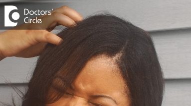 Reasons for itchy scalp and how to treat it - Dr. Rasya Dixit 14 1680983292 maxresdefault