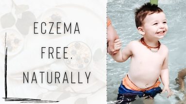 Eczema Tips 10 1680984675 maxresdefault