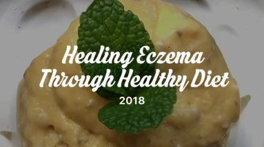 Healing Eczema With Diet (Topical Steroid Withdrawal) 8 1680985028 maxresdefault