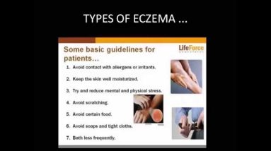 Types Of Eczema 6 1680985377 maxresdefault