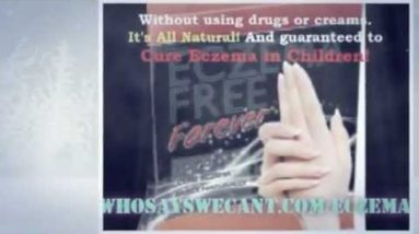 What Is The Best Emu Oil Eczema For Treating This Skin Condition? 4 1680986150 hqdefault