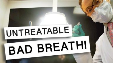Bad Breath That CAN'T Be Treated 2 1680986923 maxresdefault
