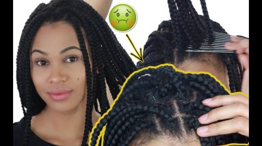 HOW TO CLEAN BOX BRAIDS | REMOVE ALL DANDRUFF & BUILD-UP 16 1680993545 maxresdefault