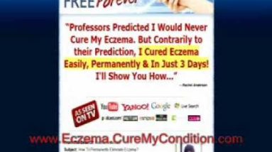 Best Eczema Treatment Program - Eczema Free Forever Review 8 1680995897 hqdefault