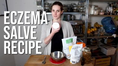 Baby Eczema Salve Recipe | How We Got It Under Control For $80.00/Year. 16 1681013517 maxresdefault
