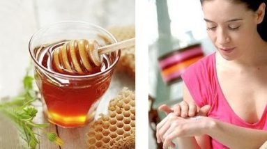 Best Natural Remedies for Eczema : How to Use Manuka Honey for Eczema 18 1681014500 hqdefault