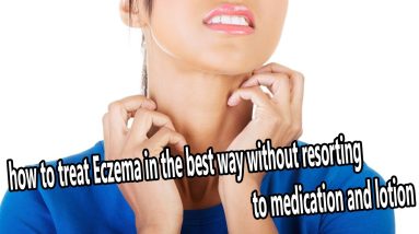 how to treat Eczema in the best way without resorting to medication and lotion - Eczema 14 1681015848 maxresdefault