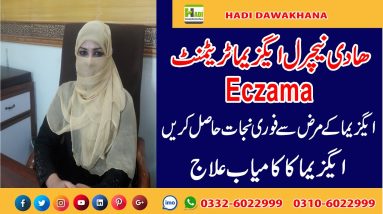 How to Treat Eczema Treatment Urdu Hindi- Kharish Ka Ilaj Elaj - Eczema Home Remedy Eczema Causes 18 1681030763 maxresdefault