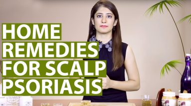Scalp Psoriasis Treatment At Home | Natural Remedies 18 1681035050 maxresdefault