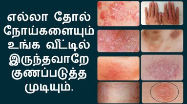 எல்லா தோல் நோய்களுக்கும் இதுதான் தீர்வு | home remedies for skin diseases in tamil 10 1681042644 maxresdefault