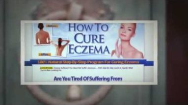Psoriasis vs Eczema : What about Eczema Vs Psoriasis ... ? 6 1681049564 hqdefault