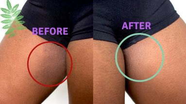 Clear Inner Thighs Fast | DIY 2 1681050274 maxresdefault
