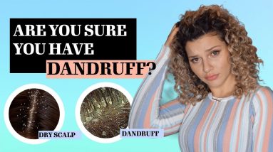 THE DIFFERENCE BETWEEN DANDRUFF VS DRY SCALP + TREATMENTS 12 1681053197 maxresdefault