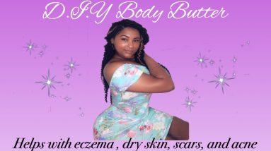 #Mschattabox #Bodybutter #DIY DIY body butter /for acne, scars, eczema and dry skin 2 1681056038 maxresdefault