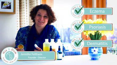 Natural Eczema Cream That Really Works! 8 1681065889 maxresdefault