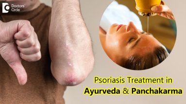 Role of Panchakarma in treating Psoriasis - Dr. Chaithanya K S | Doctors' Circle 2 1681080002 maxresdefault