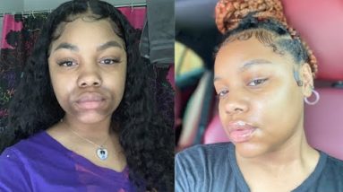 Eczema Prone Skin Routine | Morning & Night Routine 4 1681082080 hqdefault