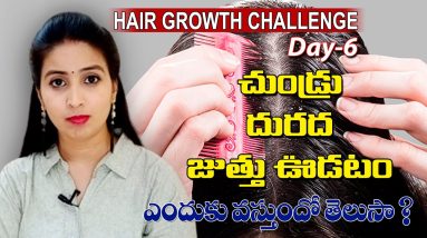 How to get rid of Dandruff|| Stop Itching || Stop Hairfall || Telugu || Poorna's Health & Beauty || 14 1681090623 maxresdefault