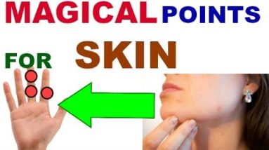 Sujok Therapy For Skin/Sujok Therapy For Skin Allergy/Sujok Therapy For Itching/Sujok Skin Problems 8 1681091401 hqdefault