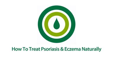 How to Treat Psoriasis and Eczema | Natural Psoriasis & Eczema Treatment Video 8 1681107414 maxresdefault