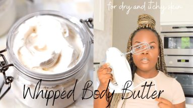 Whipped Body Butter for Dry Acne Prone Skin, Scars, Eczema 4 1681110950 maxresdefault
