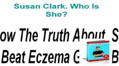 Susan Clark Eczema-Does Beat Eczema Guide Really Work? 14 1681111134 maxresdefault