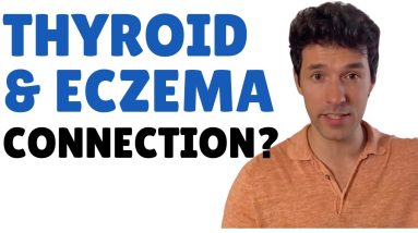 Can Thyroid Disease Cause Eczema? 10 1681112867 maxresdefault