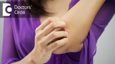 Is Eczema a genetic disease? - Dr. Jagadish Puttarangappa 4 1681136079 maxresdefault