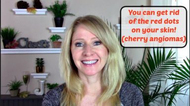 How I got rid of those red dots on my skin 20 1681136525 maxresdefault