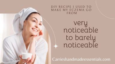 Eczema Skincare - Moisturizer that I use everyday 2 1681152120 maxresdefault