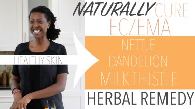 ECZEMA CURE - NETTLE, DANDELION, AND MILK THISTLE | VIAHERBS 18 1681163430 maxresdefault