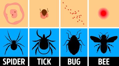 How to Identify a Bug Bite and What to Do With It 8 1681166355 maxresdefault