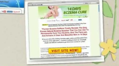 Vitamins For Eczema -- Supplements to Help the Skin Heal 4 1681167080 hqdefault