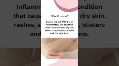 How to care for your sensitive skin, including eczema and psoriasis 6 1681182168 maxresdefault