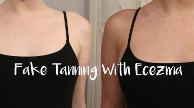Tanning With Eczema | Fake It Friday 20 1681193154 maxresdefault