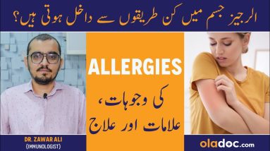 Allergy Ka Ilaj In Urdu - Allergies Symptoms Treatment - Allergy Ki Alamat - How To Treat AllergIes 20 1681195588 maxresdefault
