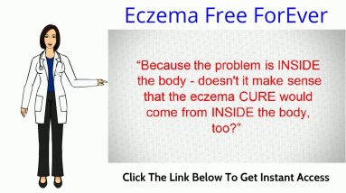 Eczema On Neck ? Check Out How to Cure the Eczema on Your Neck 16 1681201466 maxresdefault