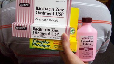 Top 7 Best Calamine Lotions for Itching, Acne, Hives, Eczema, and Poison Ivy 14 1681204314 maxresdefault
