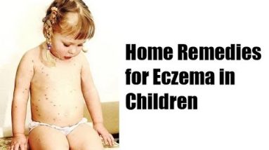 Best Home Remedies for Eczema in Babies : Home Remedies for Eczema in Children 4 1681204795 hqdefault