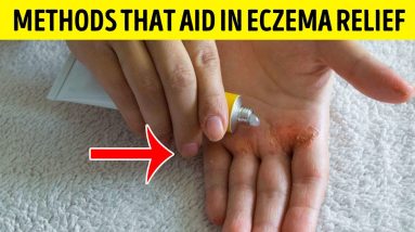 ✅Dry Skin || Eczema and || How To Treat Eczema 14 1681206727 maxresdefault