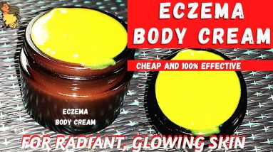 Homemade Eczema body butter/How to make eczema body cream.Diy body butter.100% effective/G G & YOU 12 1681207963 maxresdefault