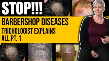Trichologist Talks About Common Barbershop Diseases: Folliculitis, Impetigo, Etc 12 1681218210 maxresdefault