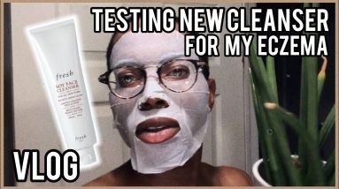HOW TO: CARING FOR ECZEMA (FOR BEGINNERS/FIRST TIMERS) *INSTANT RESULTS* + PLANT CARE | Owen Oslaywe 20 1681253482 maxresdefault