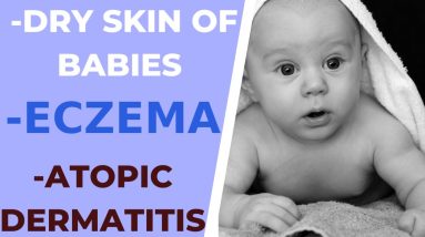 Extreme dry skin of babies| Eczema | Atopic Dermatitis| Dust allergy | How to cure eczema | 4 1681257821 maxresdefault